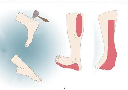 今日头条 小腿骨头疼,常见病因及缓解方法