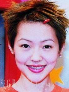 明星整容孩子丑照片